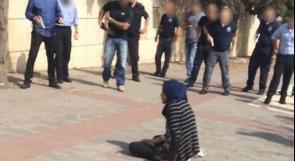 صورة قديمة توثّق إصابة الطفلة مرح بكير قبل 9 سنوات تُتداول حديثًا