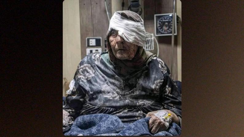 صورة قديمة لمُسنة مصابة في سوريا تُتداول حديثًا على أنها في قطاع غزة صورة قديمة لمُسنة مصابة في سوريا تُتداول حديثًا على أنها في قطاع غزة